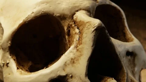 Human Skull Analysis Stock Footage 72252718