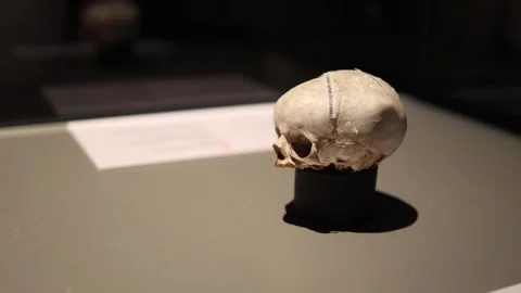 Human skull anatomy model dramatic light Video stock 330679790