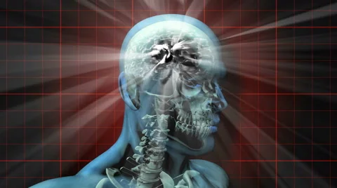 A human skull and brain electrically charged with thought - Brainstorm 105 Stock Footage
