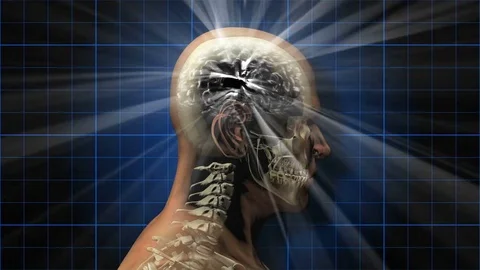 A human skull and brain electrically charged with thought. Stock Footage 85154627