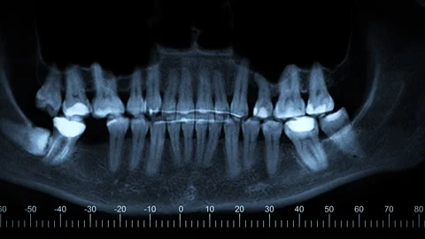 Human skull and teeth Stock Footage 276086921