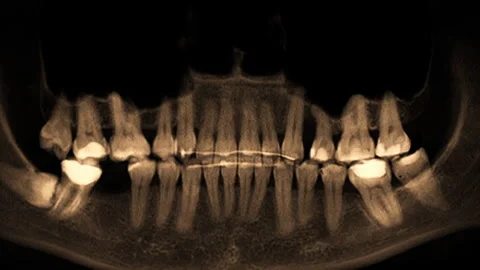 Human skull and teeth Stock Footage 276087071