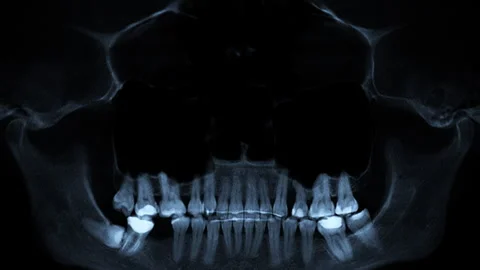 Human skull and teeth Stock Footage 276087338