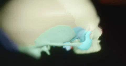 Human skull bones in different colors Stock Footage 313623124