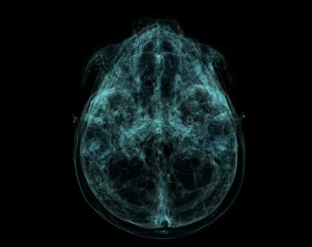 Human Skull, Brain by CT Scan. X-ray Visualization Inside Of Skull. 3D Illust Stock Illustration