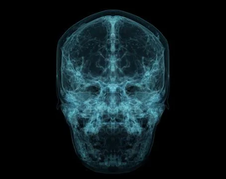 Human Skull, Brain by CT Scan. X-ray Visualization Inside Of Skull. 3D Illust Stock Illustration