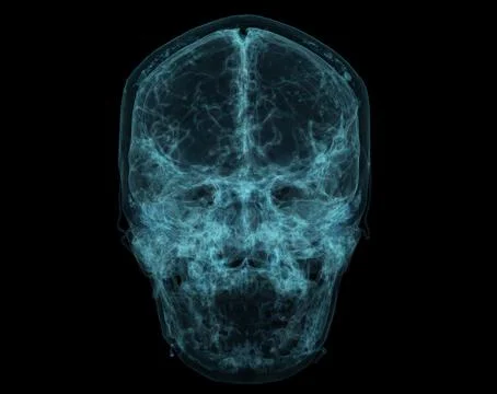 Human Skull, Brain by CT Scan. X-ray Visualization Inside Of Skull. 3D Illust Stock Illustration