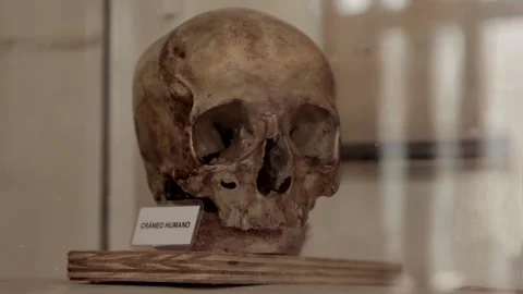 Human Skull on Display in a Museum. Close Up. Stock Footage 98736115