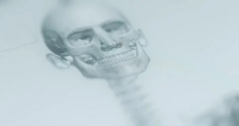 Human skull, facial bones view Stock Footage 313622732