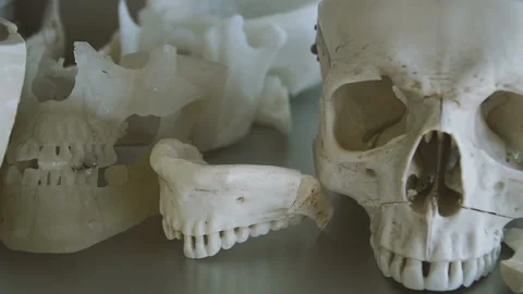 The human skull. The layout of the human skull is on the table Stock Footage 100082736
