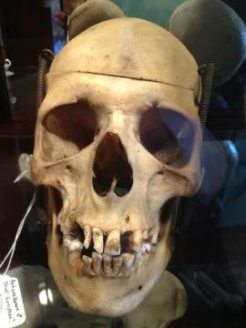 Human Skull Stock Photos