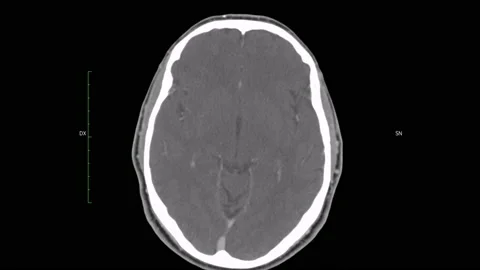Human Skull scanner - 4K - ProRes Stock Footage 164237928