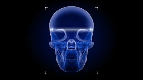 A human skull with scanning paths to detect abnormalities, 4K video Stock Footage 290011278