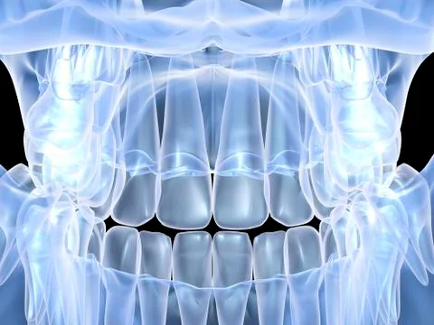 Human skull with teeth, computer artwork Illustrazione stock