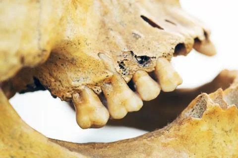 Human skull teeth Stock Photos