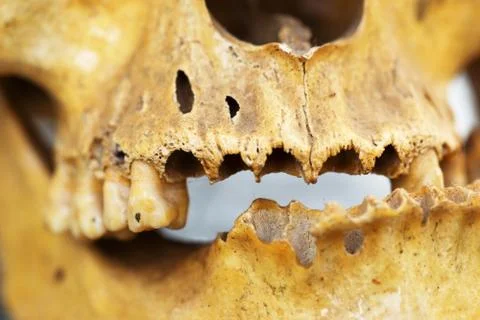 Human skull teeth Stock Photos