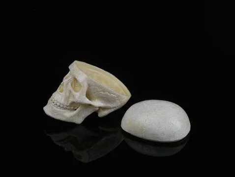 Human skull without the top of the head, which lies nearby on a black backgro Stock Photos