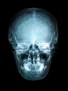 Human skull X-ray front view image film Stock Photos