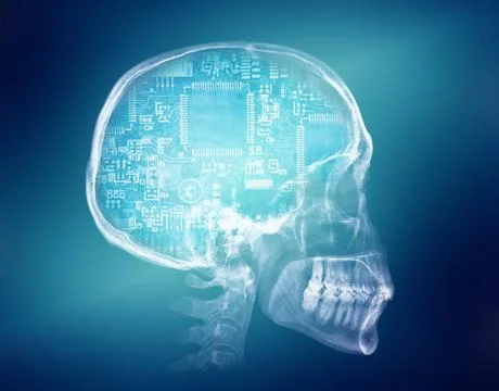  Human skull X-ray image. Artificial intelligence concept Human skull X-ra... Stock Photos