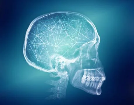  Human skull X-ray image. Artificial intelligence concept Human skull X-ra... Stock Photos