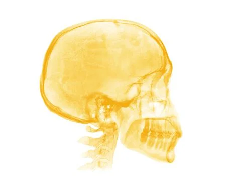 Human skull. Yellow X-ray image on white background Stock Illustration