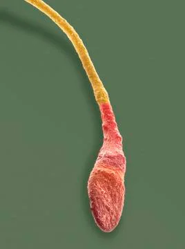 Human sperm cell, SEM Stock Photos