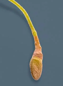 Human sperm cell, SEM Stock Photos