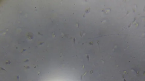 Human sperm cells on microscope Stock Footage 77607972