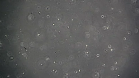 Human sperm cells seen through a phase contrast microscope. Stock Footage 252786222