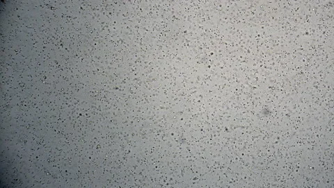 Human sperm cells seen under low magnification bright field microscopy. Stock Footage 158092277