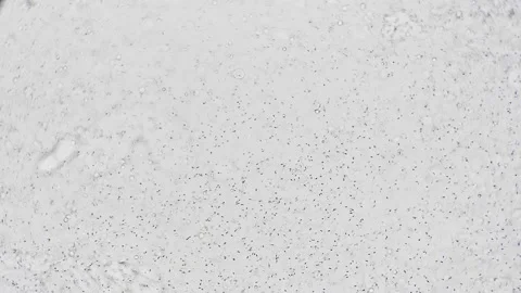 Human sperm in magnification 100 sperm swim quickly in the ejaculate on a white Video stock 241869983