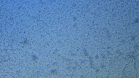 Human sperm, microscopic magnification Stock Footage 167352032