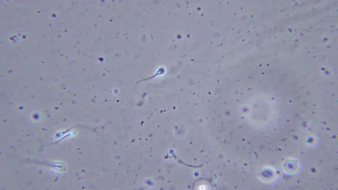 Human sperms under Bright field Microscope 스톡 동영상 80255118