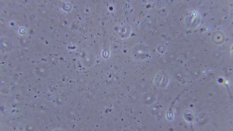 Human sperms under Bright field Microscope Video stock 80259339