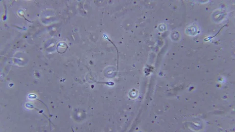 Human sperms under Bright field Microscope Video stock 80262737