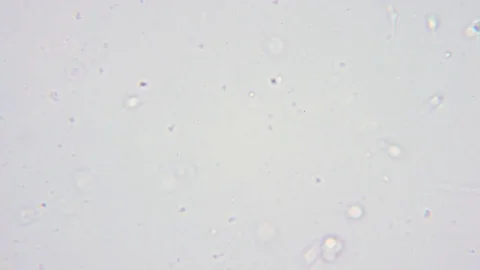 Human sperms under Bright field Microscope Video stock 80270379
