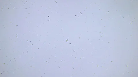Human sperms under Bright field Microscope Video stock 80311345
