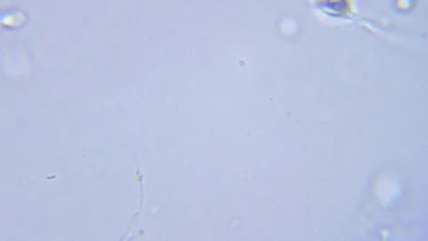 Human sperms under Bright field Microscope Video stock 80358343