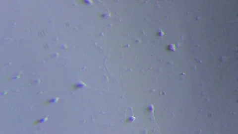 Human sperms under Oblique light Microscope Video stock 80267099