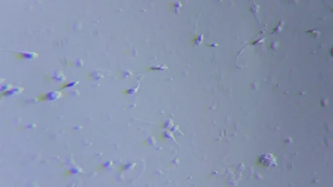 Human sperms under Oblique light Microscope Video stock 80268478