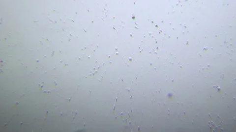 Human sperms under Oblique light Microscope 스톡 동영상 80268494