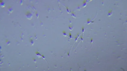 Human sperms under Oblique light Microscope Video stock 80268565
