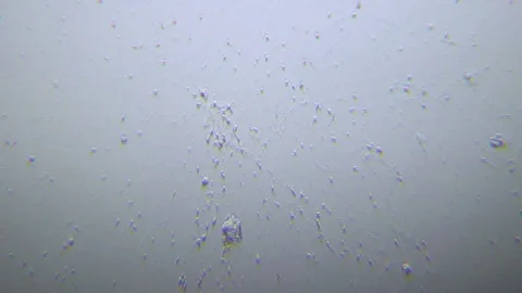 Human sperms under Oblique light Microscope Video stock 80269701