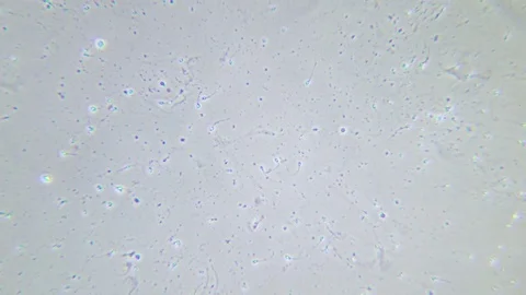 Human sperms under Phase contrast Microscope 스톡 동영상 80255410