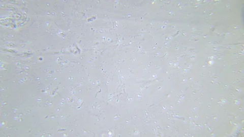 Human sperms under Phase contrast Microscope Video stock 80259494