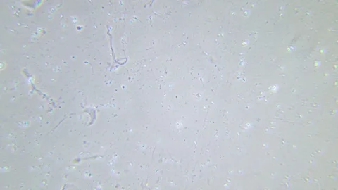 Human sperms under Phase contrast Microscope Video stock 80268192