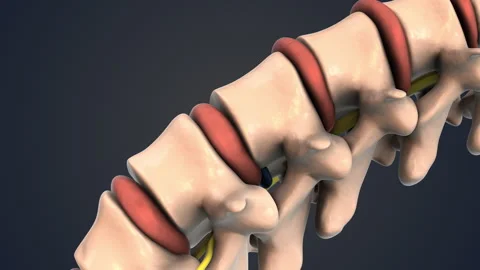 Human spine with a compressed nerve root Stock Footage 272590015