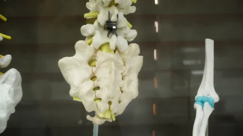 Human spine with titanium rods and screws used for spinal fusion surgery Stock Footage 334333014