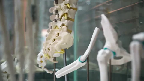 Human spine with titanium rods and screws used for spinal fusion surgery Stock Footage 334564957