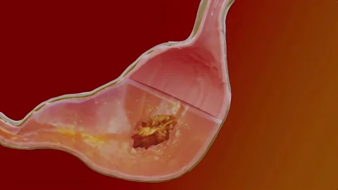 Human Stomach Anatomy Digestion, 3D reander Stock Footage